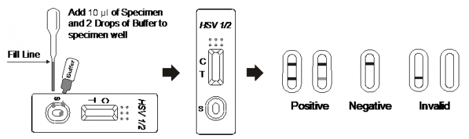 De zijanalyses HSV 1/2 van Stroomimmunochromatographic Snelle de Testcassette van IgG voor Serum of Plasma