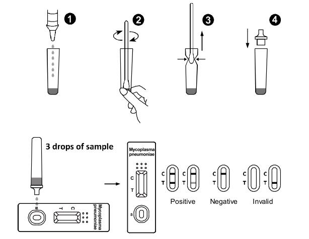 Mycoplasma van de het Antigeen Zijstroom van Pneumoniae de Analyses Snelle Test van Immunochromatographic