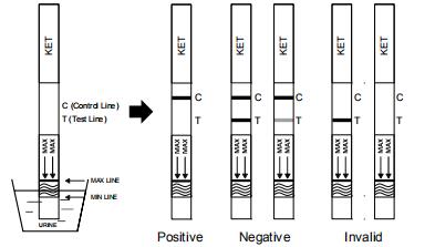 Hoog - Druggebruik Van de kwaliteits Nauwkeurig Ketamine Één de Kenmerkende Uitrustingen van StepTesting in Menselijke Urine met Ce