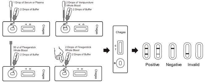 Chagas Snelle Testcassette (Geheel Bloed/Serum/Plasma)