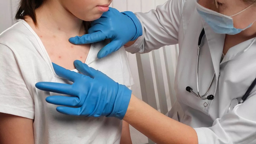 Het laatste nieuws van het bedrijf over Malaria: snel verspreid - Hoe kunt u zich beschermen?