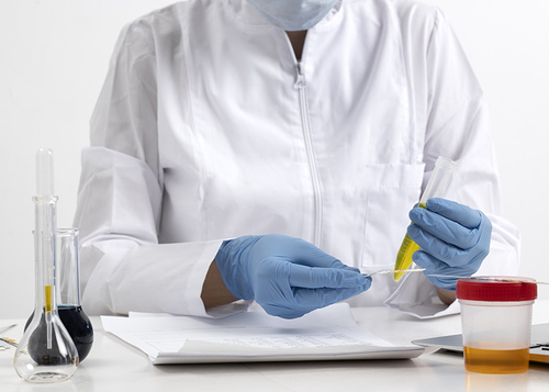 Het laatste nieuws van het bedrijf over Wat kan urine over uw gezondheid onthullen?