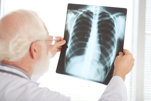 Het laatste nieuws van het bedrijf over Wat moeten wij weten over TB-preventie?