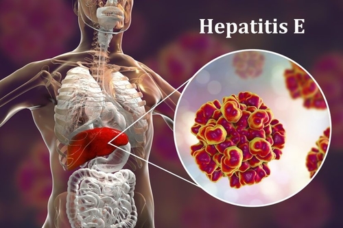 Het laatste nieuws van het bedrijf over Virusschade voor de voortplanting: de onzichtbare gevaren van hepatitis E