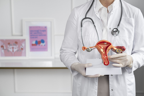 Het laatste nieuws van het bedrijf over Endometriose sterk gekoppeld aan verhoogd risico op eierstokkanker
