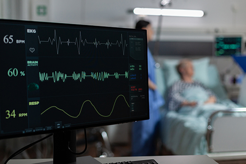 Laatste bedrijfsblogs Inzicht in Atriumfibrilleren (AFib)