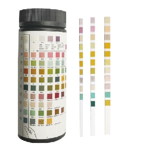 Latest company news about Geen wat zou in urine na een Urineonderzoek moeten lijken?