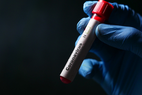 Latest company news about SARS-CoV-2 cyclusdrempel: Metrisch die van belang is (of niet)